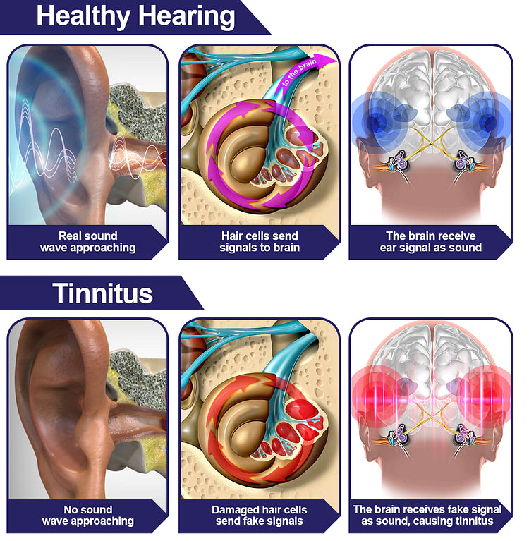 ππππππβ’ Red Light Therapy Ear Plugs Pro π ππ% ππ
π
+ Free Shipping !π